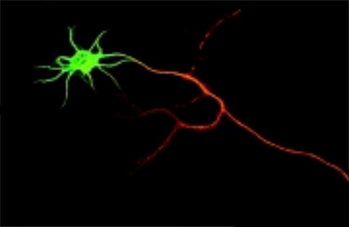 DSCR1 is required for both axonal growth cone extension and steering